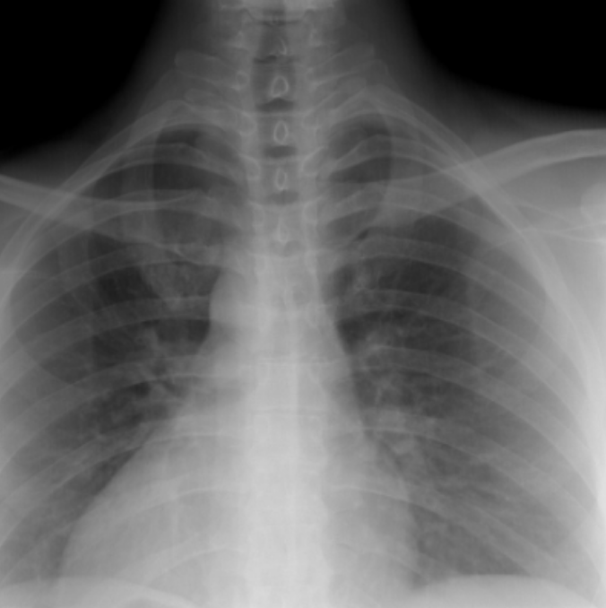 【動画配信】体幹の機能解剖・運動学の理解とリハビリテーション