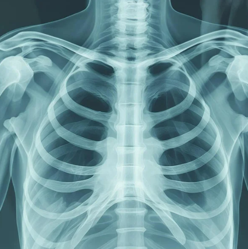 呼吸リハに必要な胸部レントゲン・呼吸機能検査の理解|理学療法士・作業療法士向け呼吸リハスクール基礎編