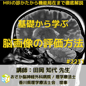 若手理学療法士や作業療法士は脳画像のみかたで悩んでいませんか？