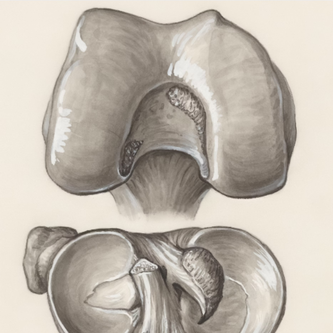 【動画配信】膝関節の機能解剖・運動学の理解とリハビリテーション