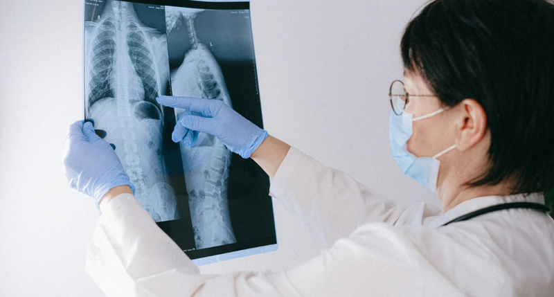 PT・OTのための整形外科疾患のレントゲン画像の診かた｜一括申込