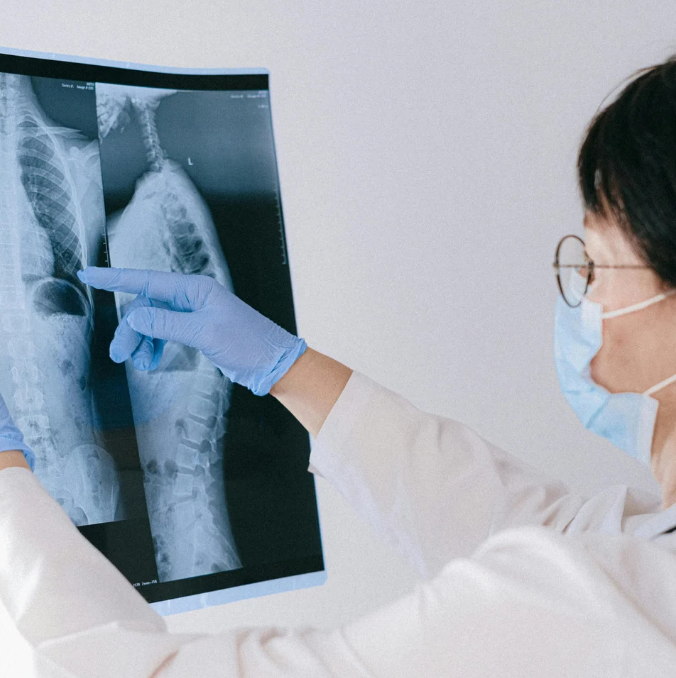 PT・OTのための整形外科疾患のレントゲン画像の診かた｜上腕・上肢のレントゲン画像の診かた